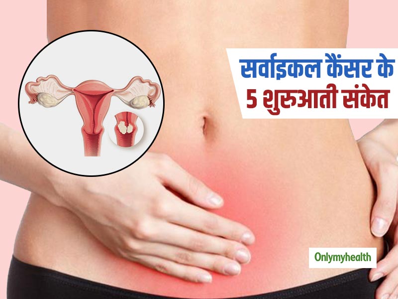 Cervical Cancer Signs: 35 से 40 की उम्र में बढ़ जाता है सर्वाइकल कैंसर का खतरा, जानें इसके 5 शुरुआती संकेत